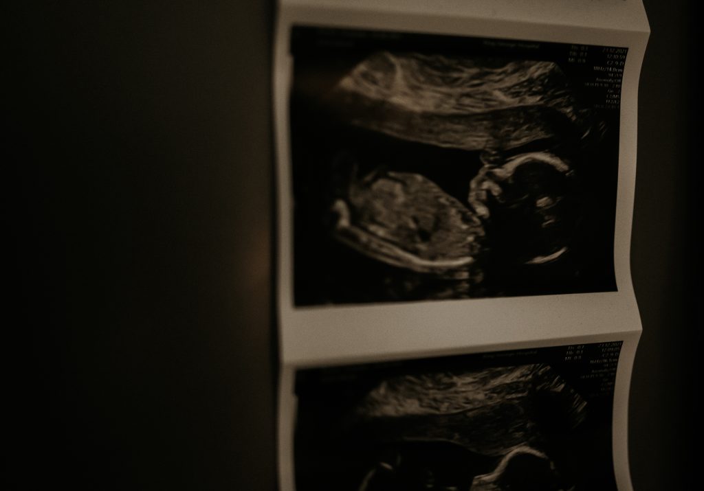 Birth & Newborn photography session at home in essex